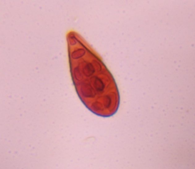 Alternaria mold spore under a microscope, verified by PollyMap