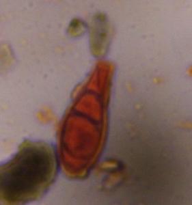 Alternaria mold spore under a microscope, verified by PollyMap