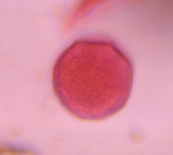 Grass pollen under a microscope, verified by PollyMap