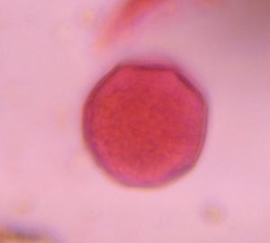 Grass pollen under a microscope, verified by PollyMap