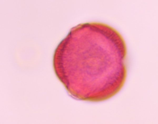 Artemisia pollen under a microscope, verified by PollyMap