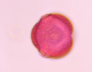 Artemisia pollen under a microscope, verified by PollyMap