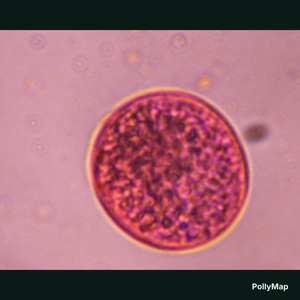 Grass pollen under a microscope, verified by PollyMap