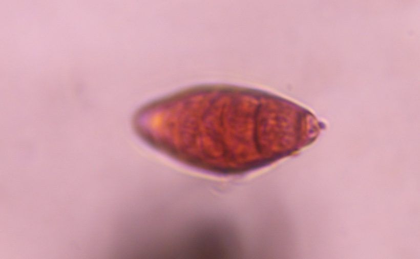 Another microscope image of Bipolaris/Drechslera, verified by PollyMap
