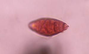 Bipolaris/Drechslera mold spore under a microscope, verified by PollyMap