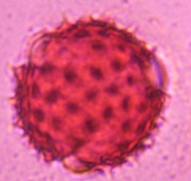 Another microscope image of Asteraceae, verified by PollyMap