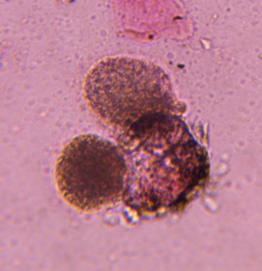 Pine pollen under a microscope, verified by PollyMap