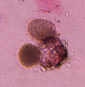 Pine pollen under a microscope, verified by PollyMap