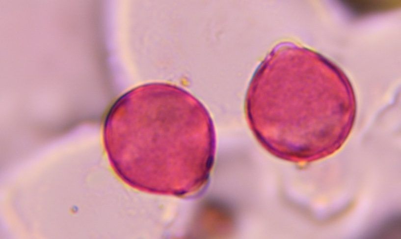 Mesquite pollen under a microscope, verified by PollyMap