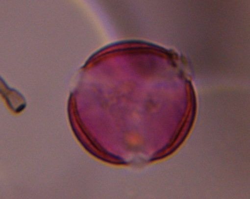 Artemisia pollen under a microscope, verified by PollyMap