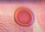 unidentified pollen under a microscope, verified by PollyMap