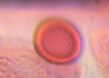 unidentified pollen under a microscope, verified by PollyMap