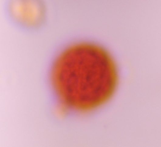 Chenopod pollen under a microscope, verified by PollyMap