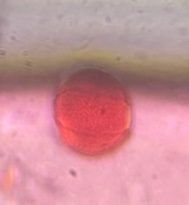 Oak pollen under a microscope, verified by PollyMap