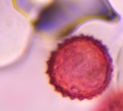 Asteraceae pollen under a microscope, verified by PollyMap
