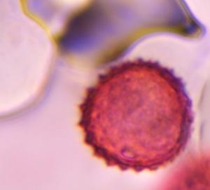 Asteraceae pollen under a microscope, verified by PollyMap