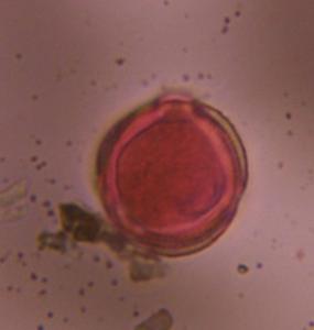 Artemisia pollen under a microscope, verified by PollyMap