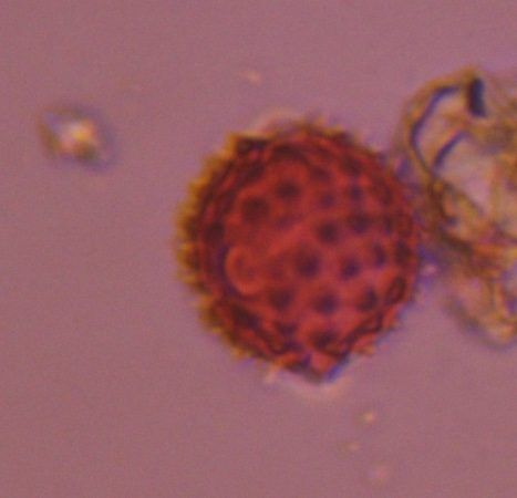 Microscope image of Asteraceae, verified by PollyMap