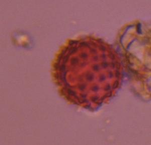 Asteraceae pollen under a microscope, verified by PollyMap
