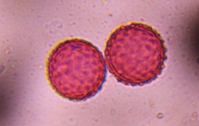 Another microscope image of Chenopod, verified by PollyMap