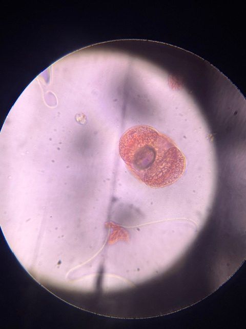 Another microscope image of Pine, verified by PollyMap
