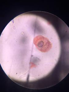 Pine pollen under a microscope, verified by PollyMap