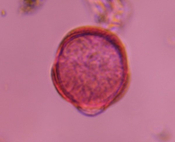 Artemisia pollen under a microscope, verified by PollyMap
