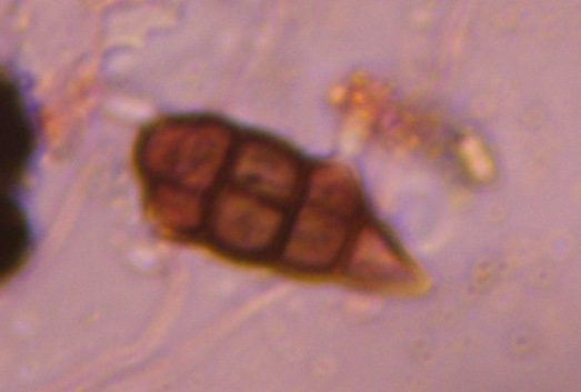 Alternaria mold spore under a microscope, verified by PollyMap