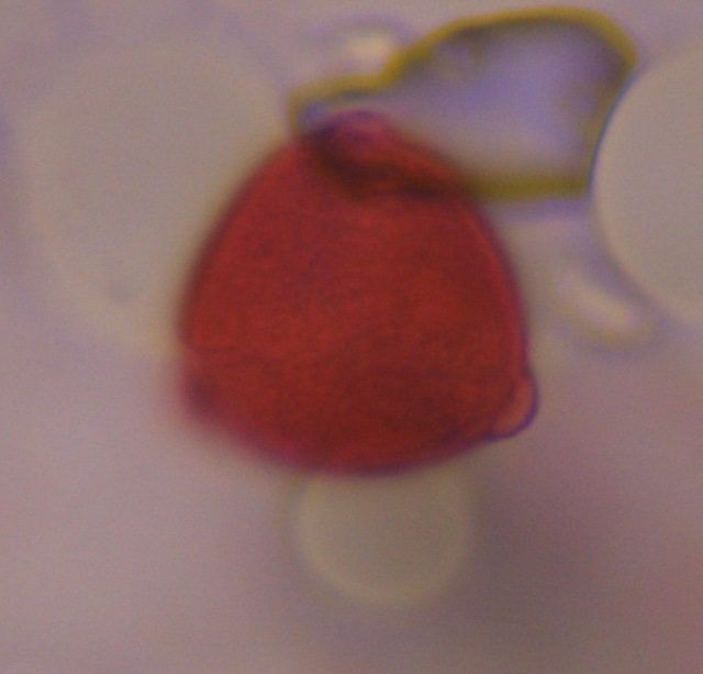Unknown pollen under a microscope, verified by PollyMap