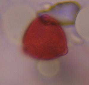 Unknown pollen under a microscope, verified by PollyMap