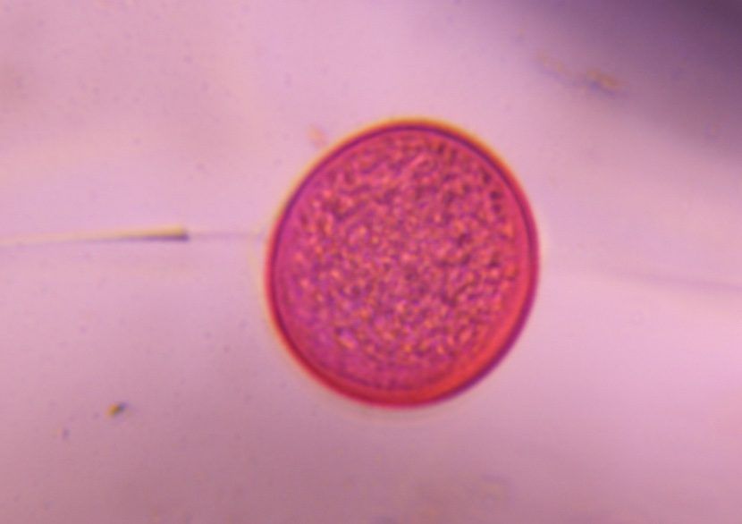 Poaceae pollen under a microscope, verified by PollyMap