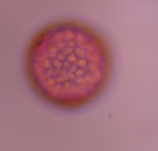 Cannabis pollen under a microscope, verified by PollyMap