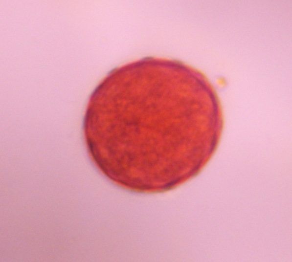 Chenopod pollen under a microscope, verified by PollyMap