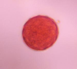 Chenopod pollen under a microscope, verified by PollyMap