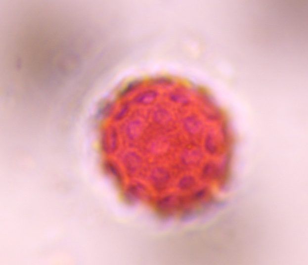 Chenopod pollen under a microscope, verified by PollyMap
