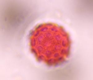 Chenopod pollen under a microscope, verified by PollyMap