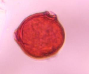 Unknown pollen under a microscope, verified by PollyMap