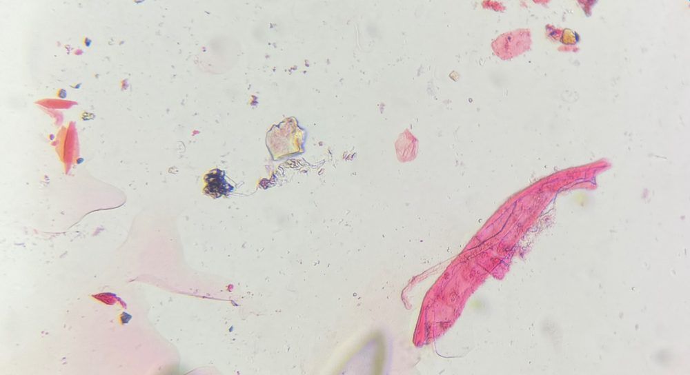 Microscope image of Debris, verified by PollyMap