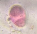 Another microscope image of Pine, verified by PollyMap