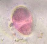 Pine pollen under a microscope, verified by PollyMap
