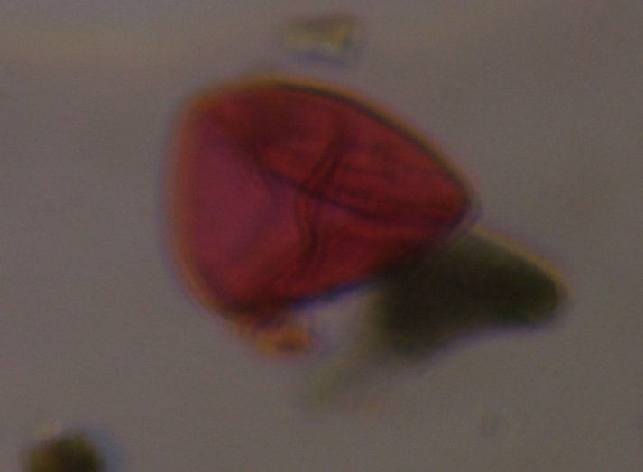 Microscope image of Unknown, verified by PollyMap