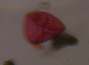 Unknown pollen under a microscope, verified by PollyMap