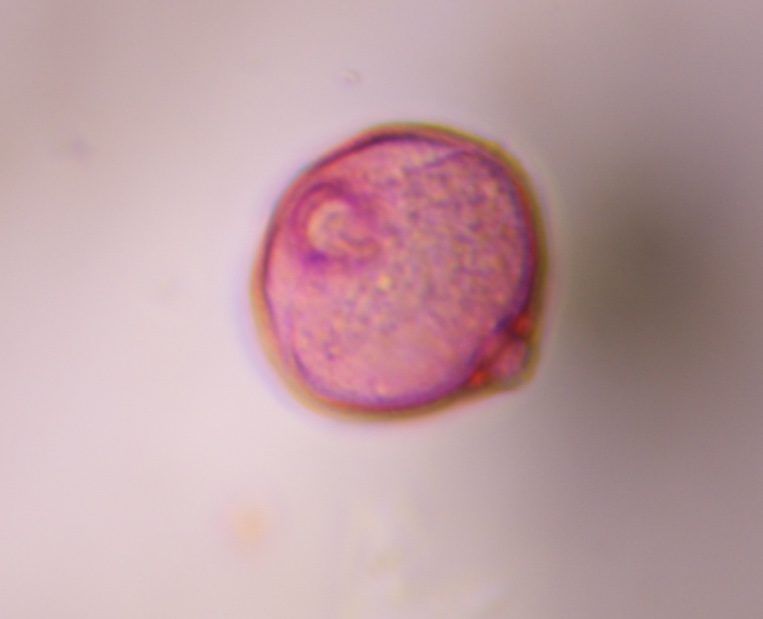 Artemisia pollen under a microscope, verified by PollyMap