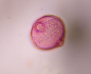 Artemisia pollen under a microscope, verified by PollyMap