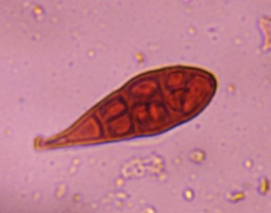 Another microscope image of Alternaria, verified by PollyMap
