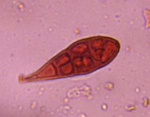 Alternaria mold spore under a microscope, verified by PollyMap