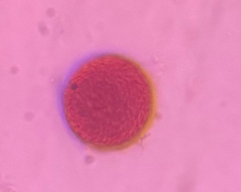 Grass pollen under a microscope, verified by PollyMap