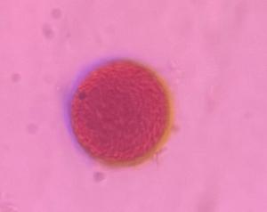 Grass pollen under a microscope, verified by PollyMap