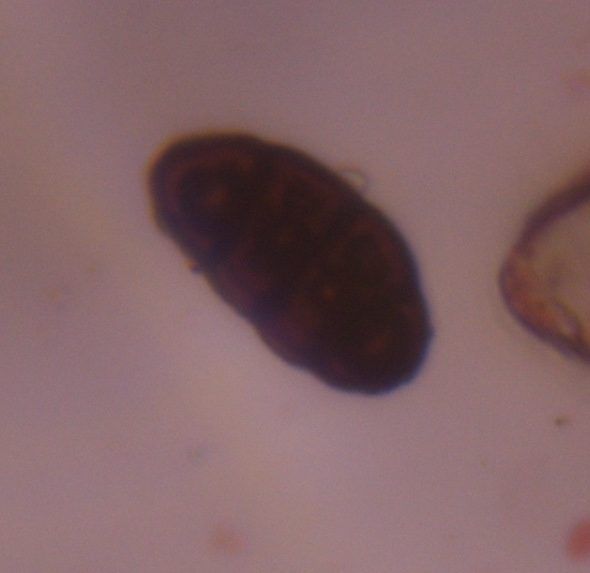 Pithomyces mold spore under a microscope, verified by PollyMap
