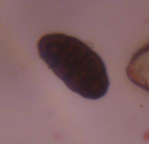 Pithomyces mold spore under a microscope, verified by PollyMap